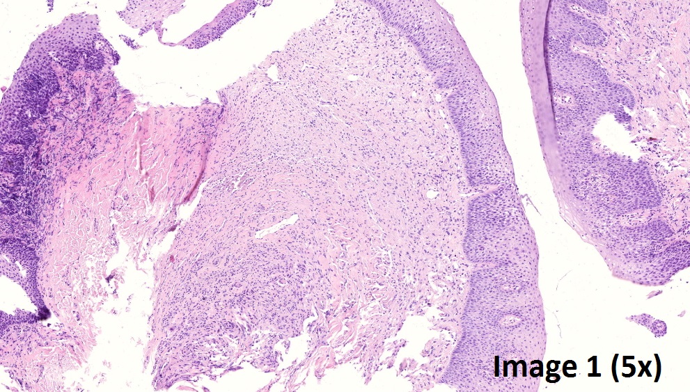Interpret These Histopathological Images Of Tongue